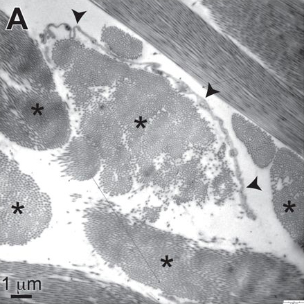 Interstitium Figure 1