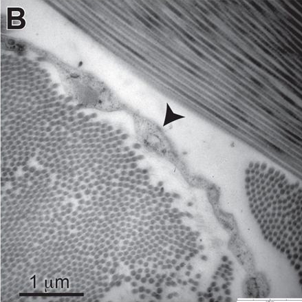 Interstitium Figure 2