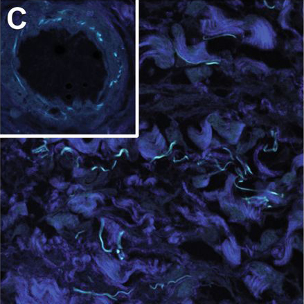 Interstitium Figure 3