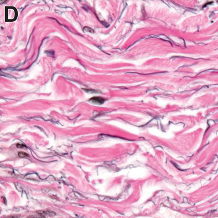 Interstitium Figure 4